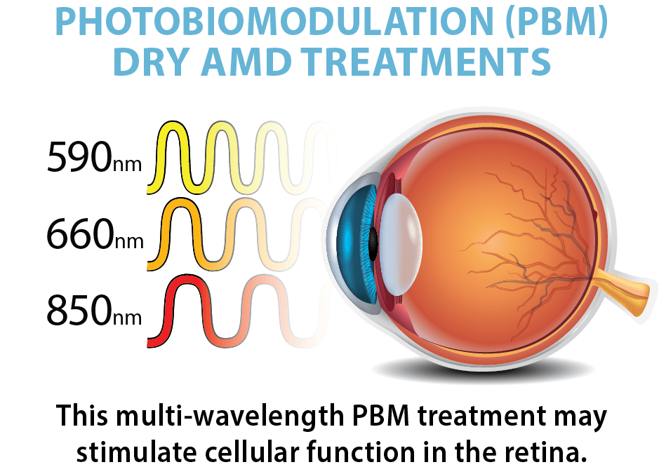 Age-Related Macular Degeneration (ARMD) diagram